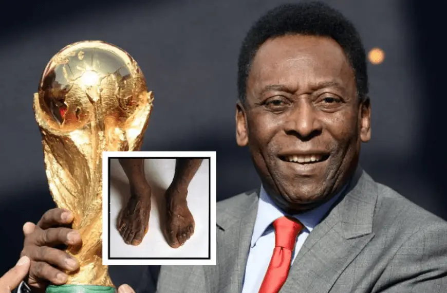 Pele’s feet to be displayed in FIFA museum?!