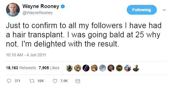 Rooney tweeting about his hair transplant