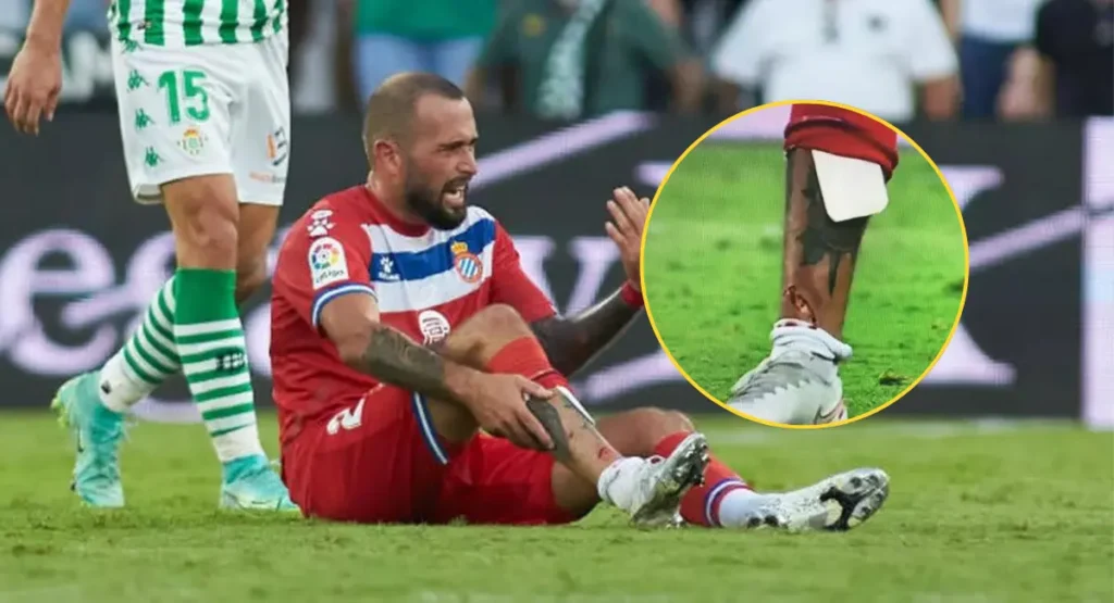 Could Alex Vidal's injury could have been prevented if he had been wearing traditional shin pads over mini ones?